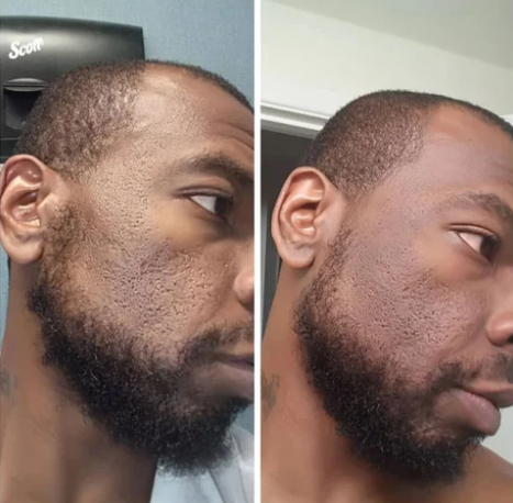 Dr Melaxin Glass Skin Kit - 6 Steps to Radiant, Glowing Skin