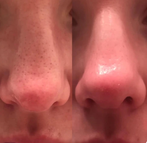 Dr Melaxin Glass Skin Kit - 6 Steps to Radiant, Glowing Skin