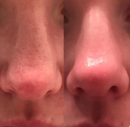 Dr Melaxin Glass Skin Kit - 6 Steps to Radiant, Glowing Skin